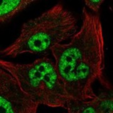 Anti-RNF14 antibody produced in rabbit Prestige Antibodies&#174; Powered by Atlas Antibodies, affinity isolated antibody, buffered aqueous glycerol solution
