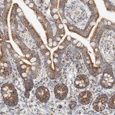 Anti-C1QBP antibody produced in rabbit Prestige Antibodies&#174; Powered by Atlas Antibodies, affinity isolated antibody, buffered aqueous glycerol solution