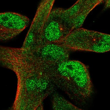 Anti-Stil Antibody Produced In Rabbit Prestige Antibodies&#174; Powered by Atlas Antibodies, affinity isolated antibody, buffered aqueous glycerol solution