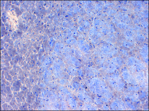 Monoclonal Anti-SCN2A1 antibody produced in mouse clone S69-3, 1&#160;mg/mL, purified immunoglobulin