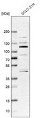 Anti-ZNF598 antibody produced in rabbit affinity isolated antibody, buffered aqueous glycerol solution
