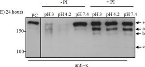 Anti-Human Kappa Light Chains (Bound and Free)&#8722;Peroxidase antibody produced in goat affinity isolated antibody, buffered aqueous solution