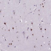 Anti-MEF2C antibody produced in rabbit Prestige Antibodies&#174; Powered by Atlas Antibodies, affinity isolated antibody, buffered aqueous glycerol solution