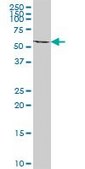 Anti-ACAD9 antibody produced in mouse IgG fraction of antiserum, buffered aqueous solution
