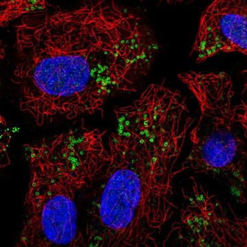 Anti-PNPLA2 antibody produced in rabbit Prestige Antibodies&#174; Powered by Atlas Antibodies, affinity isolated antibody