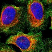 Anti-PPP3CC antibody produced in rabbit Prestige Antibodies&#174; Powered by Atlas Antibodies, affinity isolated antibody, buffered aqueous glycerol solution