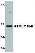 Anti-TMEM184C antibody produced in rabbit affinity isolated antibody, buffered aqueous solution
