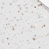 Anti-ALDH18A1 antibody produced in rabbit Prestige Antibodies&#174; Powered by Atlas Antibodies, affinity isolated antibody, buffered aqueous glycerol solution