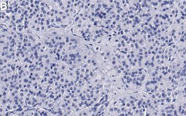 Anti-SLC12A2 Antibody, clone 1J6 ZooMAb&#174; Rabbit Monoclonal recombinant, expressed in HEK 293 cells