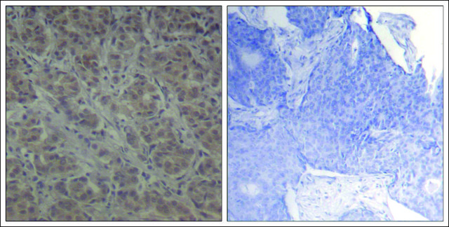 Anti-RPS6KA1 (Ab-352) antibody produced in rabbit affinity isolated antibody