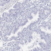 Anti-COL17A1 antibody produced in rabbit Prestige Antibodies&#174; Powered by Atlas Antibodies, affinity isolated antibody, buffered aqueous glycerol solution