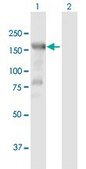 Anti-HDAC6 antibody produced in mouse purified immunoglobulin, buffered aqueous solution