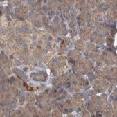Anti-TSPOAP1 antibody produced in rabbit Prestige Antibodies&#174; Powered by Atlas Antibodies, affinity isolated antibody, buffered aqueous glycerol solution, Ab2