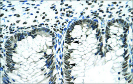 Anti-GLI2 IgG fraction of antiserum