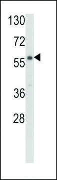 ANTI-CARS2(C-TERMINAL) antibody produced in rabbit purified immunoglobulin, buffered aqueous solution