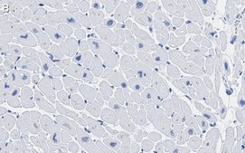 Anti-CACNA1C Antibody, clone 1F20 ZooMAb&#174; Rabbit Monoclonal recombinant, expressed in HEK 293 cells