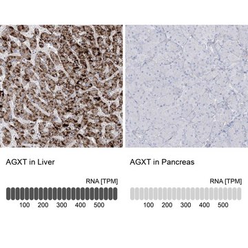 Anti-AGXT antibody produced in rabbit Prestige Antibodies&#174; Powered by Atlas Antibodies, affinity isolated antibody, buffered aqueous glycerol solution