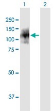 Anti-ENPP1 antibody produced in mouse IgG fraction of antiserum, buffered aqueous solution