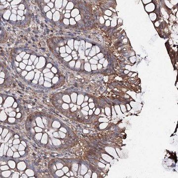Anti-COG6 antibody produced in rabbit Prestige Antibodies&#174; Powered by Atlas Antibodies, affinity isolated antibody, buffered aqueous glycerol solution