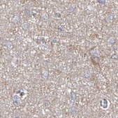 Anti-ASCC3 antibody produced in rabbit Prestige Antibodies&#174; Powered by Atlas Antibodies, affinity isolated antibody, buffered aqueous glycerol solution, ab1
