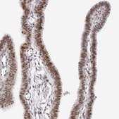 Anti-MSH6 antibody produced in rabbit Prestige Antibodies&#174; Powered by Atlas Antibodies, affinity isolated antibody, buffered aqueous glycerol solution, ab2