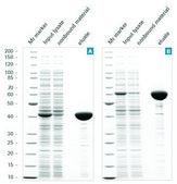 cOmplete&#8482; His-Tag Purification Resin suspension, suitable for protein purification, matrix Sepharose-CL 6B