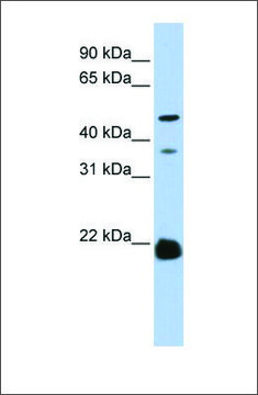 Anti-ZDHHC14 antibody produced in rabbit affinity isolated antibody