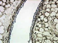 Anti-Collagen Type IV Antibody Chemicon&#174;, from goat