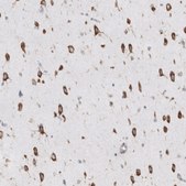 Anti-RPLP1 antibody produced in rabbit Prestige Antibodies&#174; Powered by Atlas Antibodies, affinity isolated antibody, buffered aqueous glycerol solution