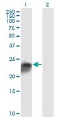 Monoclonal Anti-UCHL1 antibody produced in mouse clone 1B8-4D2, purified immunoglobulin, buffered aqueous solution