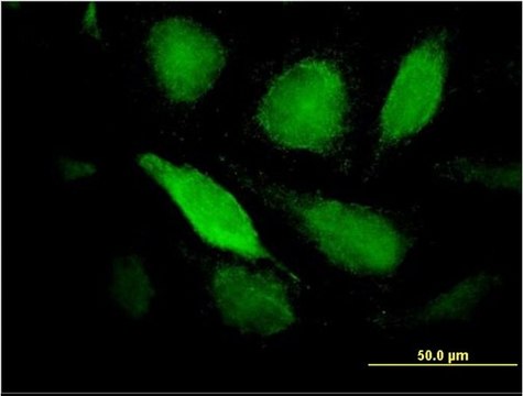 Monoclonal Anti-PTX3 antibody produced in mouse clone 2B10, purified immunoglobulin, buffered aqueous solution