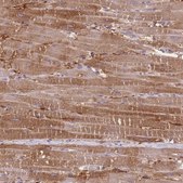 Anti-PRKAR1A antibody produced in rabbit Prestige Antibodies&#174; Powered by Atlas Antibodies, affinity isolated antibody, buffered aqueous glycerol solution