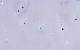 Anti-Aggrecan Antibody, clone 4B10 ZooMAb&#174; Rabbit Monoclonal recombinant, expressed in HEK 293 cells