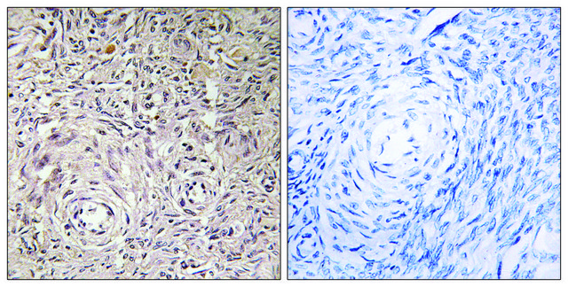 Anti-GCNT7 antibody produced in rabbit affinity isolated antibody