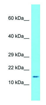 Anti-Saa1 antibody produced in rabbit affinity isolated antibody