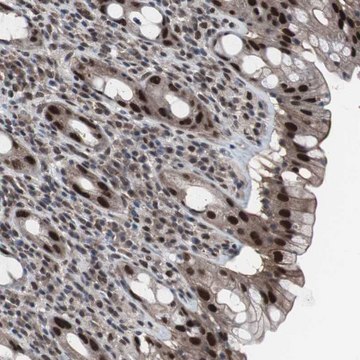 Anti-GTF2F2 antibody produced in rabbit Prestige Antibodies&#174; Powered by Atlas Antibodies, affinity isolated antibody, buffered aqueous glycerol solution