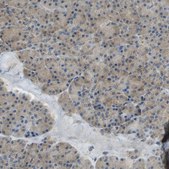 Anti-DIAPH2 antibody produced in rabbit Prestige Antibodies&#174; Powered by Atlas Antibodies, affinity isolated antibody, buffered aqueous glycerol solution
