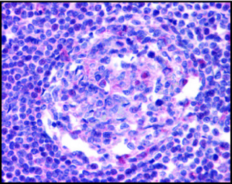 Anti-CCR5 antibody produced in rabbit IgG fraction of antiserum, buffered aqueous solution