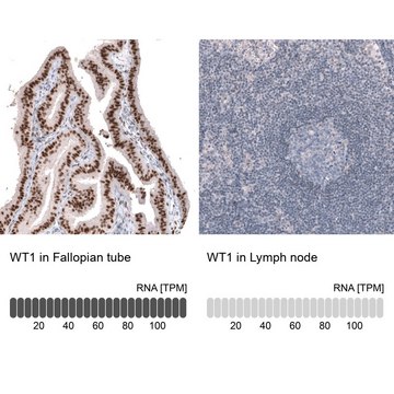 Anti-WT1 antibody produced in mouse Prestige Antibodies&#174; Powered by Atlas Antibodies, clone CL13170, purified by using Protein A, buffered aqueous glycerol solution