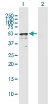 Anti-TRMT2B antibody produced in mouse purified immunoglobulin, buffered aqueous solution