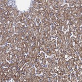 Anti-ACADSB antibody produced in rabbit Prestige Antibodies&#174; Powered by Atlas Antibodies, affinity isolated antibody, buffered aqueous glycerol solution
