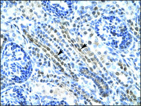 Anti-ANKRD11 antibody produced in rabbit IgG fraction of antiserum