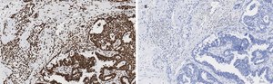 Anti-Acetyl Histone H3 (Lys9 and 14) Antibody, clone 5H20, ZooMAb&#174; Rabbit Monoclonal recombinant, expressed in HEK 293 cells