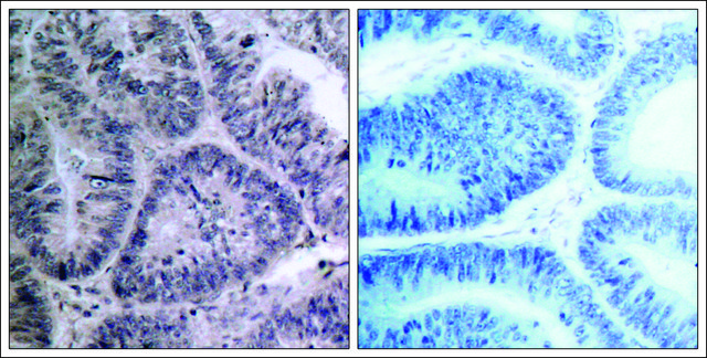 Anti-CHUK (Ab-23) antibody produced in rabbit affinity isolated antibody