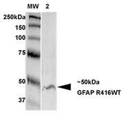 Monoclonal Anti-Lrrk2/Dardarin - Rpe antibody produced in mouse clone S231B-34, purified immunoglobulin