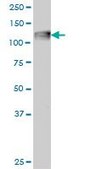Monoclonal Anti-C3 antibody produced in mouse clone 5F9, ascites fluid
