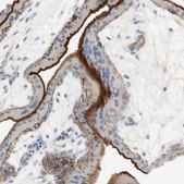 Anti-NECTIN4 antibody produced in rabbit Prestige Antibodies&#174; Powered by Atlas Antibodies, affinity isolated antibody, buffered aqueous glycerol solution