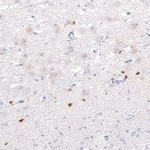 Monoclonal Anti-OTP antibody produced in mouse Prestige Antibodies&#174; Powered by Atlas Antibodies, clone CL11225, purified immunoglobulin, buffered aqueous glycerol solution