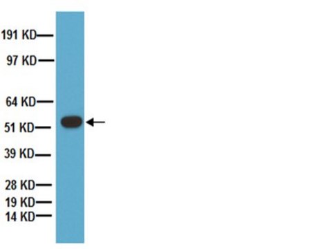 Anti-Tryptophan Hydroxylase Antibody Chemicon&#174;, from sheep