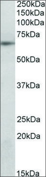 Anti-SOCS5 (N-terminal) antibody produced in goat affinity isolated antibody, buffered aqueous solution